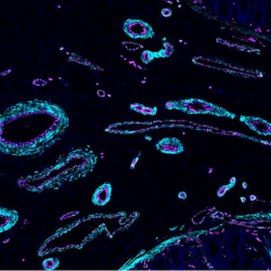 Human ileum, part of the small intestine 