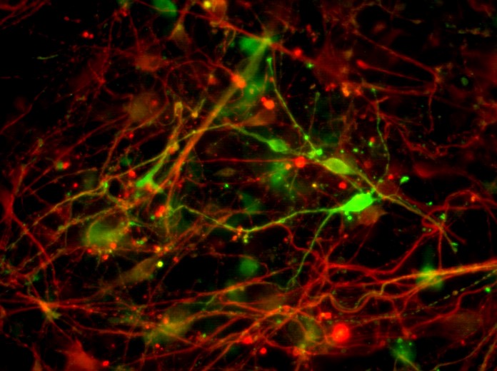 Dopaminergic neurons differentiated from embryonic stem cells using a clinical grade protocol and reagents—TH (green), Btub (red)