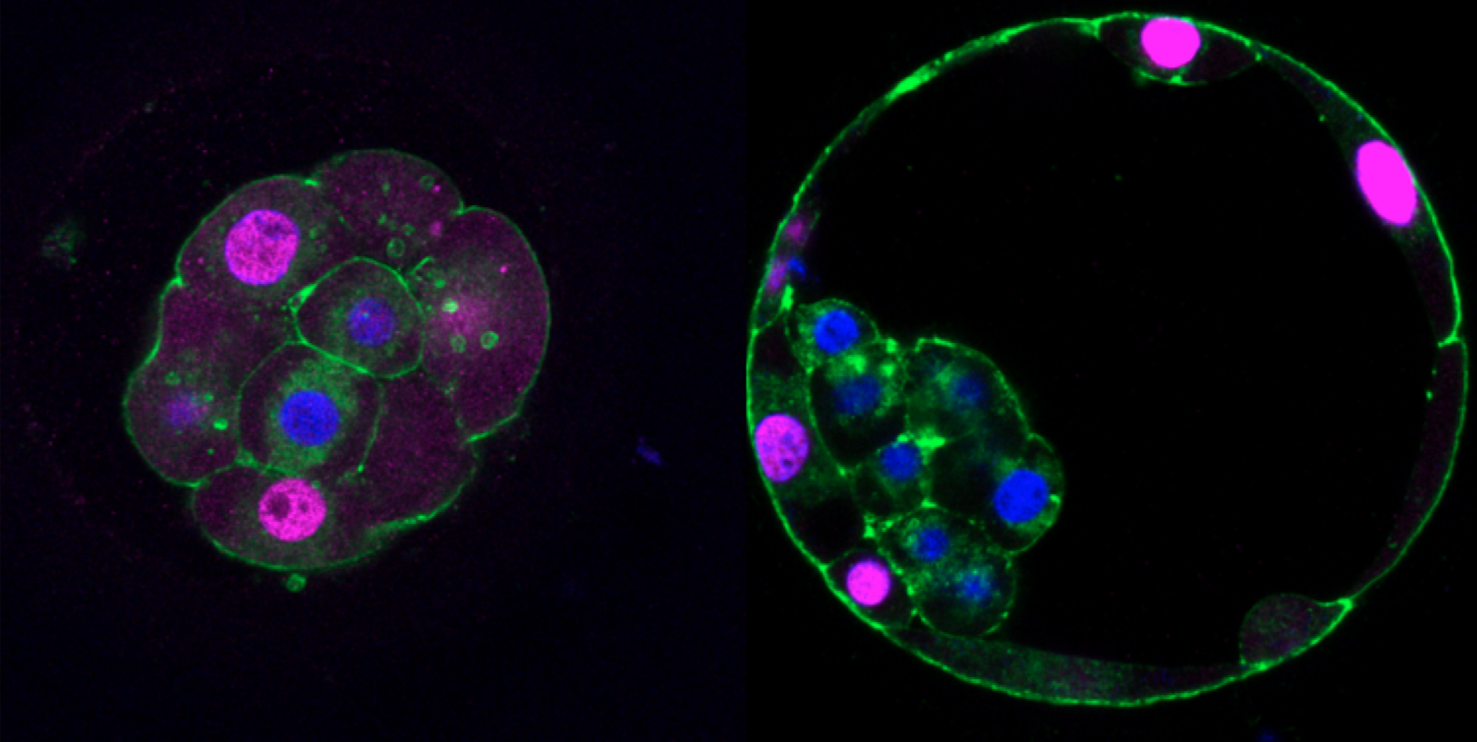Fluorescent images showing gene expression in human embryos.