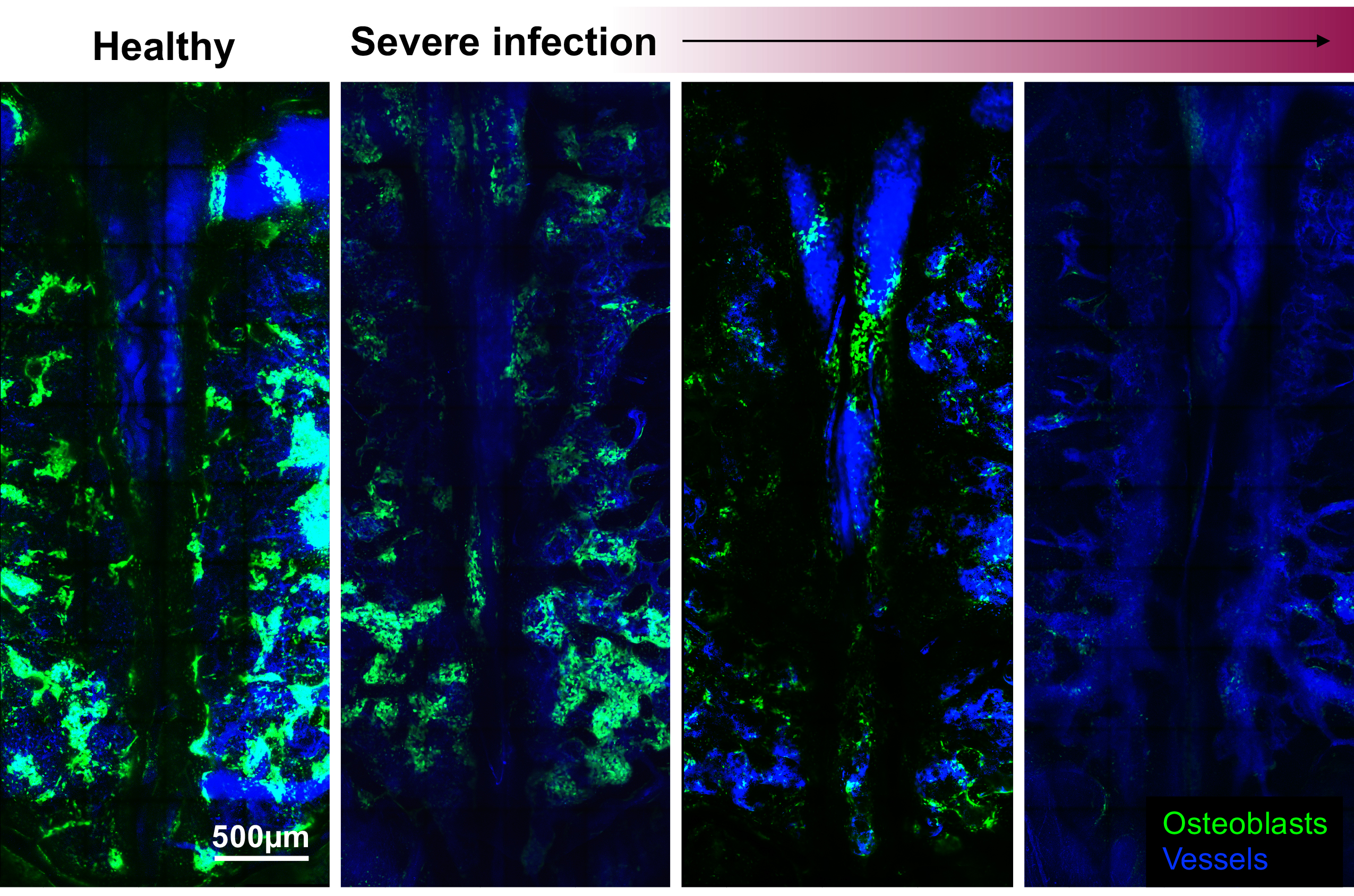 After infection, osteoblasts steadily decrease until they are completely destroyed 