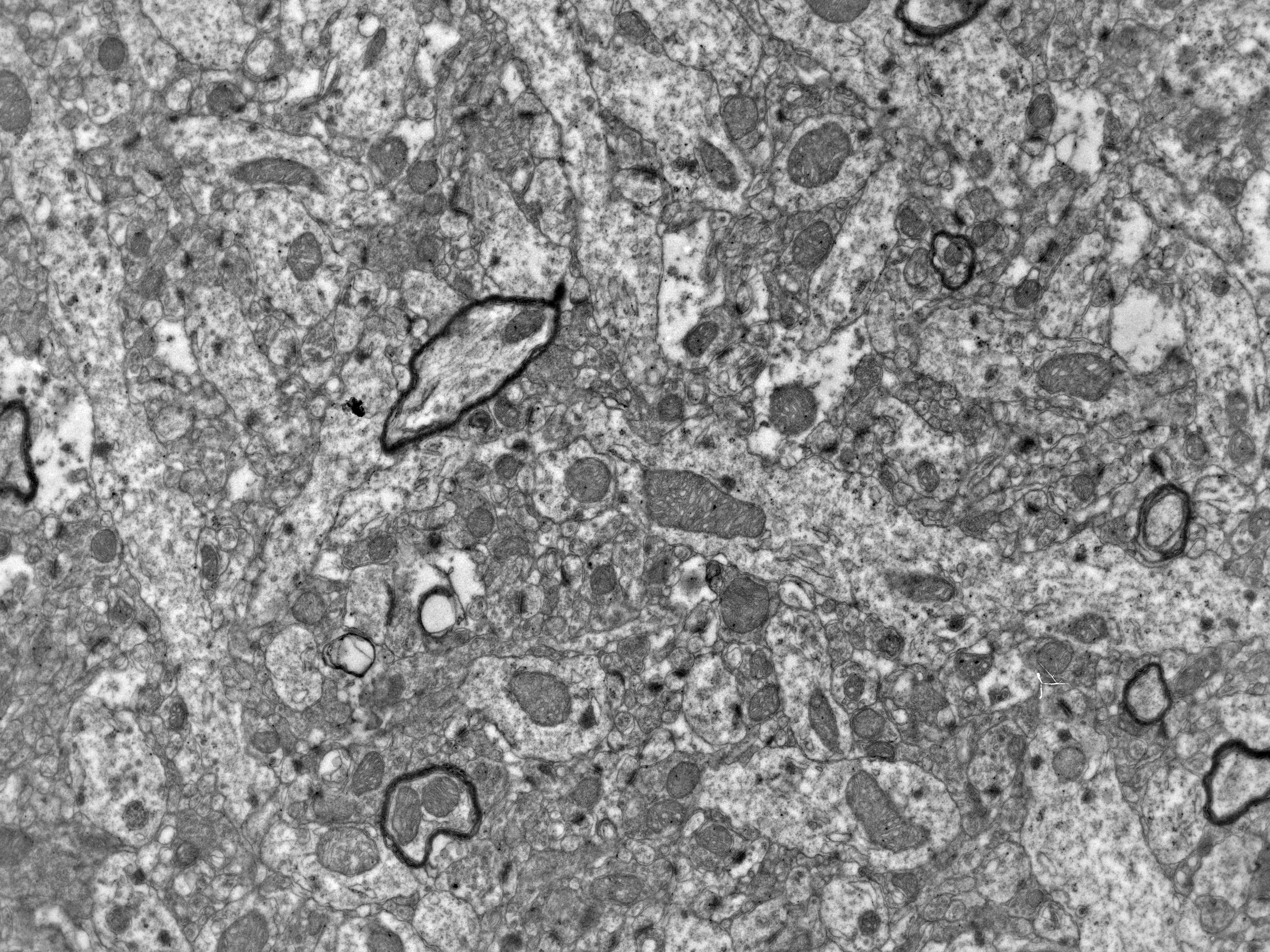 TEM of brain tissue