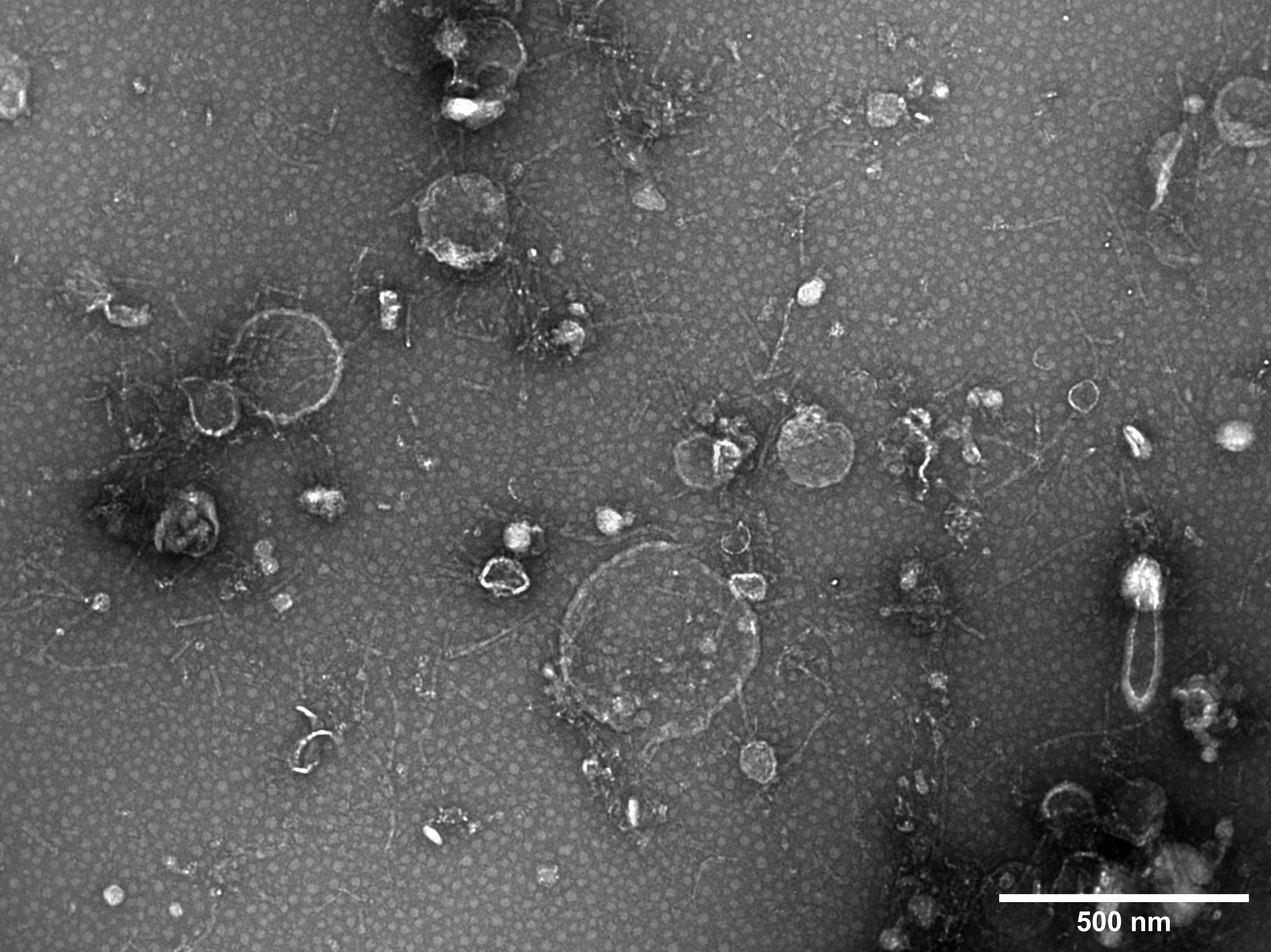 TEM of vesicles