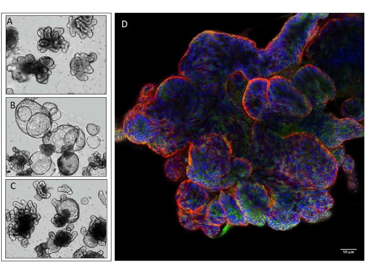 Brightfield images of Human Intestinal Epithelial Organoids 