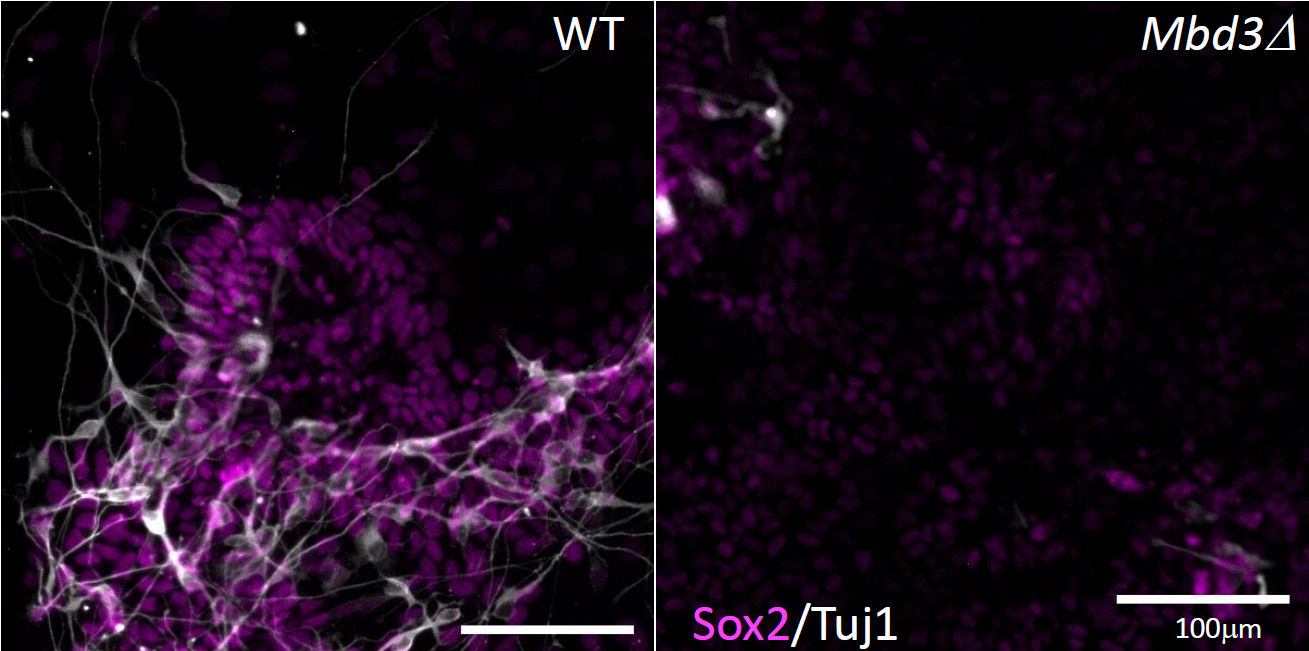 EpiStem Cells form neurons (white) when differentiated in culture (left). In the absence of Mbd3/NuRD (right) cells are unable to undergo neural differentiation. EpiStem Cells form neurons (white) when differentiated in culture (left). In the absence of Mbd3/NuRD (right) cells are unable to undergo neural differentiation.