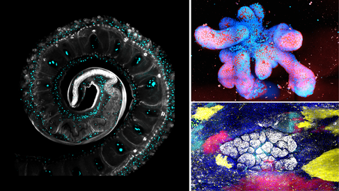 Research images: Left- microscopic image of whipworm; top right- intestinal organoid; bottom right - tumour nebula. 