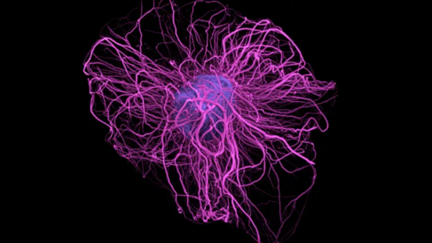 Image of dopamine neuron
