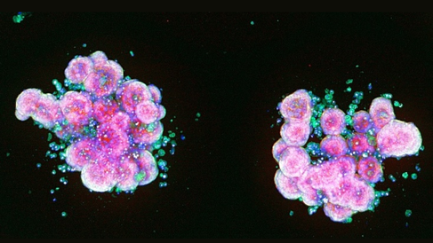 Human intestinal organoid microscopy image