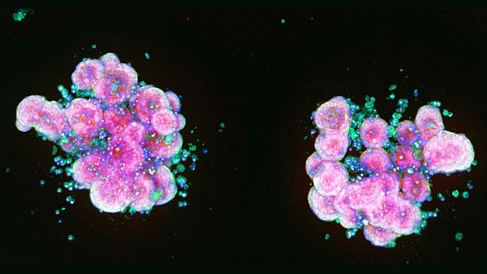 Human intestinal organoid microscopy image