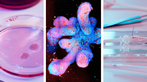 Heart, intestine, and liver organoids 