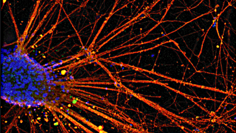 Research image from Barker Lab 