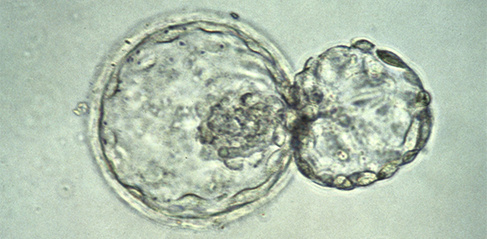 A human embryo at the blastocyst stage, about six days after fertilization, viewed under a light microscope. The embryo is in the process of "hatching" out of the zona pellucida - the tough outer membrane - just before implanting in the wall of the uterus