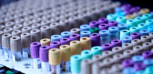 Test tubes