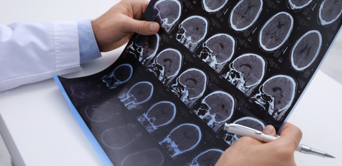 Image of brain scans 