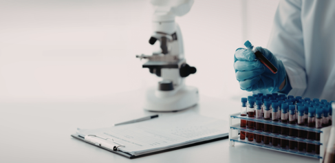 Image in a lab of a microscope and blood samples 