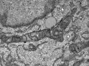 TEM of a mitochondrion