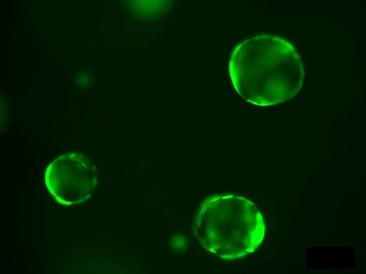 Cambridge discovery paves the way for new diabetes treatment options