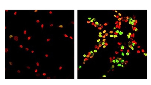 Cambridge scientists reverse ageing process in rat brain stem cells