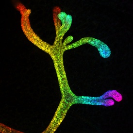 Breast cancer scientists use innovative 3D imaging to help track cancer cells