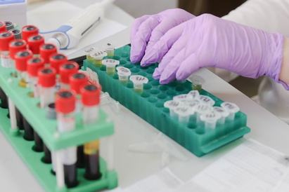 Discovering the numerous paths of stem cell decision making