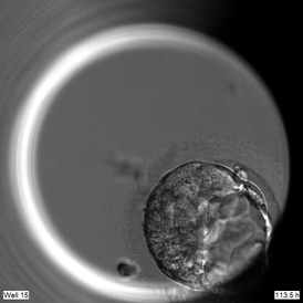 Genome editing reveals role of gene important for human embryo development