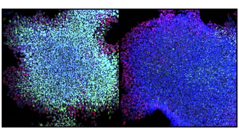 Missing link found between pathways involved in cell development