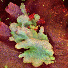Scientists identify ‘cell of origin’ in skin cancers