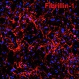 New research from Sinha Lab recreates genetic heart disease in a dish