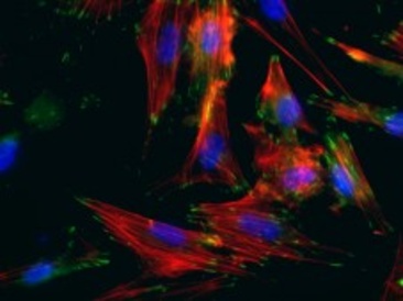 Smooth muscle cells created from patients’ skin cells