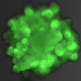 A human embryonic lung organoid with Green Fluorescent Protein expressed in every cell.