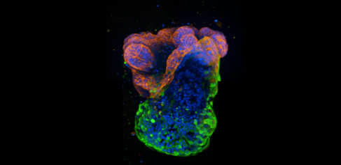 Image of an organoid