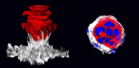 Image of tumour development 