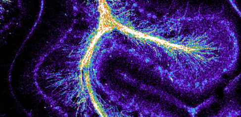 myelination in cerebelllum