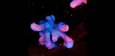  image of a patient derived, human intetstial organoid.