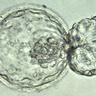 A human embryo at the blastocyst stage, about six days after fertilization, viewed under a light microscope. The embryo is in the process of "hatching" out of the zona pellucida - the tough outer membrane - just before implanting in the wall of the uterus