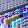 Test tubes
