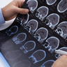Image of brain scans 