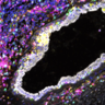 Immune cell exhaustion observed in breast tissue from carriers of BRCA1 and BRCA2 mutations long before breast cancer develops. Credit: Sara Pensa