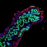 3D cell scaffolding supports future transplant therapies