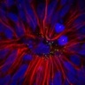 Brain Cells Created from Patient's Skin