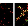 Cambridge scientists reverse ageing process in rat brain stem cells