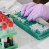 Discovering the numerous paths of stem cell decision making