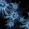 New Research on Brain Structure Highlights Cells Linked to Alzheimer's and Autism