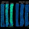 Potentially cancerous cells kept in check by competitive neighbours, study of oesophagus finds