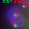 Understanding X-chromosome silencing in humans