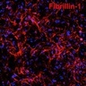 New research from Sinha Lab recreates genetic heart disease in a dish