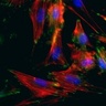 Smooth muscle cells created from patients’ skin cells