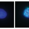 Stem cells and genetics: the ‘perfect storm’ for cancer progression