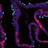 Miniature ‘womb lining’ grown in lab could reveal secrets of menstrual cycle and early pregnancy