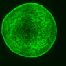 Ball of neuroblastoma cells forming mature nerves after drug treatment (Credit: Kirsty Ferguson/Developmental Cell)
