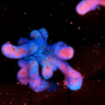  image of a patient derived, human intetstial organoid.